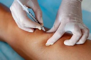 Curso Online Básico em Escleroterapia